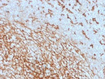 IHC analysis of CD14 antibody in human tonsil tissue. Formalin-fixed, paraffin-embedded human tonsil shows HRP-DAB brown membranous and cytoplasmic staining in macrophage-rich areas using CD14 antibody (clone LPSR/2408). Hematoxylin counterstain highlights nuclei in blue. Heat induced epitope retrieval was performed by boiling tissue sections in 10mM Tris with 1mM EDTA, pH 9, for 10-20 minutes followed by cooling at room temperature for 20 minutes.