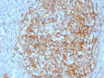 IHC analysis of CD14 antibody in human lymph node tissue. Formalin-fixed, paraffin-embedded human lymph node shows HRP-DAB brown membranous and cytoplasmic staining in macrophages and sinus histiocytes using CD14 antibody (clone LPSR/2408). Hematoxylin counterstain highlights nuclei in blue. Heat induced epitope retrieval was performed by boiling tissue sections in 10mM Tris with 1mM EDTA, pH 9, for 10-20 minutes followed by cooling at room temperature for 20 minutes.