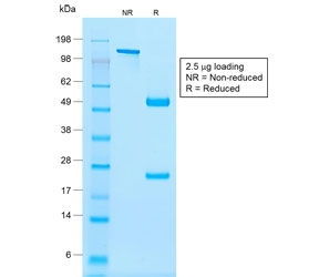 SDS-PAGE analysis of purified, BSA-free recombinant NKX2.2 antibody (clone rNX2/294) as confirmation of integrity and purity.
