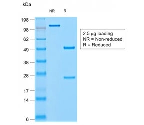 SDS-PAGE analysis of purified, BSA-free recombinant Chromogranin A antibody (clone rCHGA/798) as confirmation of integrity and purity.
