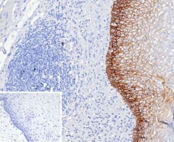 CD44v6 Antibody for IHC Esophageal Epithelium. Immunohistochemistry analysis of CD44 variant 6 / CD44 expression in FFPE human esophagus tissue using mouse monoclonal antibody clone CD44V6/2496. Strong, continuous membranous HRP-DAB brown staining is observed across stratified squamous epithelial layers, clearly outlining cell borders and highlighting epithelial stratification consistent with CD44v6-associated differentiation and tissue organization. The staining pattern emphasizes uniform epithelial architecture and supports its use as a marker of epithelial maturation in esophageal tissue. Heat induced epitope retrieval was performed by boiling tissue sections in pH 9 10mM Tris with 1mM EDTA for 20 min followed by cooling at RT before testing.