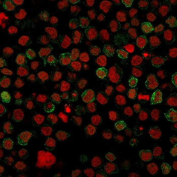 CD22 Antibody for IF. Immunofluorescence analysis of CD22/Siglec-2 expression in human Ramos B cell lymphoma cells using CD22 Immunofluorescence Antibody clone BLCAM/1796. CD22 staining (green) highlights prominent membrane-associated localization outlining B cell surfaces, consistent with its role as a B cell receptor regulatory protein, while Reddot nuclear stain (red) labels nuclei. The staining pattern supports identification of CD22-positive B cell populations and visualization of cell surface receptor distribution in lymphoma-derived cells.