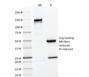 SDS-PAGE analysis of purified, BSA-free CD22 Antibody for IF / CD22 Immunofluorescence Antibody (clone BLCAM/1796) as confirmation of integrity and purity.
