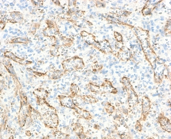 Immunohistochemistry of VEGI antibody in human spleen tissue. FFPE human spleen shows cytoplasmic and membranous HRP-DAB brown staining within vascular endothelial and scattered stromal cell populations, consistent with Vascular endothelial growth inhibitor / TNFSF15 localization in immune and vascular compartments. Clone TLRM1-2R was used as a recombinant rabbit monoclonal antibody for detection. Heat-induced epitope retrieval was performed by boiling sections in 10 mM Tris with 1 mM EDTA, pH 9, for 10-20 minutes followed by cooling at room temperature for 20 minutes prior to staining.