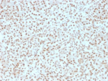 AKT1 Antibody Pancreas IHC. Immunohistochemistry testing of FFPE human pancreas with AKT1 antibody (clone AKT1/2491). HIER: boil tissue sections in pH 9 10mM Tris with 1mM EDTA for 10-20 min followed by cooling at RT for 20 min. 