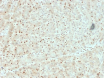 AKT1 Antibody Pancreas Signaling IHC. Immunohistochemistry of FFPE human pancreas tissue using AKT1 antibody highlights HRP-DAB brown cytoplasmic and nuclear staining in pancreatic epithelial cells, consistent with active PI3K-AKT signaling, while stromal regions show lower background; detection was performed with clone AKT1/2552. HIER: boil tissue sections in pH6 10mM citrate buffer for 10-20 min followed by cooling at RT for 20 min.