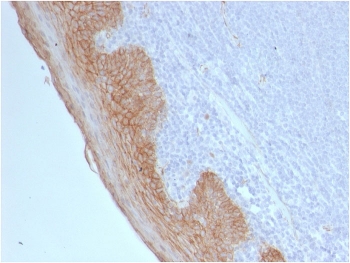 IHC testing of FFPE human tonsil tissue with Beta Catenin antibody (clone CTNNB1/2098). HIER: boil tissue sections in pH 9 10mM Tris with 1mM EDTA for 20 min and allow to cool before testing.