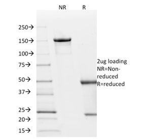 SDS-PAGE analysis of purified, BSA-free p21 antibody (clone AC8) as confirmation of integrity and purity.