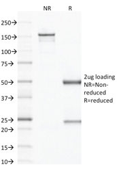 SDS-PAGE analysis of purified, BSA-free CD79b antibody (clone IGB/1843) as confirmation of integrity and purity.