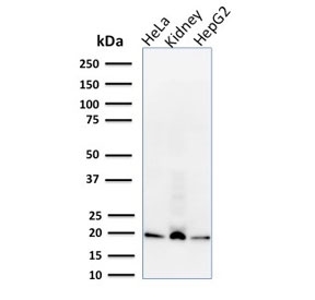 Western blot testing of human HeLa, kidney and HepG2 cell lysate with ARF1 antibody (clone 1A9/5). Predicted molecular weight ~21 kDa.