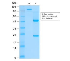 SDS-PAGE analysis of purified, BSA-free recombinant Basic Cytokeratin antibody (clone rKRTH/2148) as confirmation of integrity and purity.