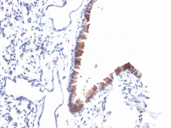 IHC testing of FFPE mouse lung with Mesothelin antibody (clone MSLN/2131). HIER: boil tissue sections in pH 9 10mM Tris with 1mM EDTA for 10-20 min followed by cooling at RT for 20 min.