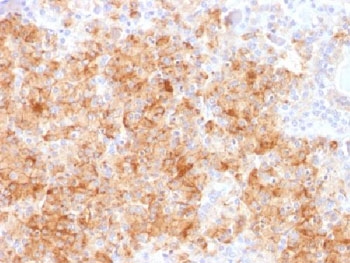 IHC analysis of FFPE human parathyroid gland stained with recombinant Chromogranin A antibody (CHGA/1731R). Required HIER: steam sections in pH6 citrate buffer for 10-20 min.