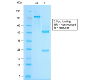 SDS-PAGE analysis of purified, BSA-free recombinant Chromogranin A antibody (clone CHGA/1815R) as confirmation of integrity and purity.