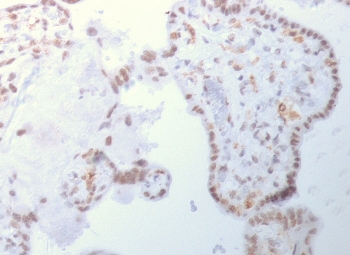 DNMT3A Antibody Placenta IHC. Immunohistochemistry analysis of FFPE human placental tissue using DNMT3A Antibody shows nuclear staining in trophoblast and stromal cell populations, consistent with localization of DNMT3A / DNA methyltransferase 3 alpha as a nuclear epigenetic regulator. Staining is observed within cell nuclei lining placental structures, reflecting active de novo DNA methylation processes during development. Hematoxylin counterstain provides nuclear contrast and tissue architecture. HIER: boil FFPE tissue sections in 1 mM EDTA, pH 9, for 10-20 min and allow to cool before testing.