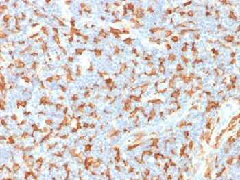IBA1 Antibody Human Lymph Node IHC. Immunohistochemistry analysis of FFPE human lymph node tissue using IBA1 Antibody (clone AIF1/1909) shows strong HRP-DAB brown cytoplasmic staining in macrophages and dendritic-like cells within paracortical and sinusoidal regions, highlighting AIF1 / IBA1 expression in tissue-resident immune cells that share functional lineage with microglia, consistent with its role as a microglia marker and macrophage activation marker; nuclei are counterstained blue. HIER: boil tissue sections in pH 6 citrate buffer for 10-20 min and allow to cool before testing.