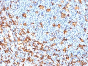 Immunohistochemistry of Recombinant IBA1 Antibody Microarray Validated clone rAIF1/1909 in human tonsil tissue. Formalin-fixed, paraffin-embedded tonsil demonstrates cytoplasmic HRP-DAB brown staining in scattered macrophage-lineage cells within the lymphoid parenchyma and interfollicular regions, consistent with Allograft inflammatory factor 1 expression in tissue macrophages and activated immune cells. Heat-induced epitope retrieval was performed by boiling tissue sections in pH 6, 10mM citrate buffer for 10-20 minutes followed by cooling at room temperature for 20 minutes prior to staining. The recombinant monoclonal antibody clone rAIF1/1909 was used as the primary antibody.