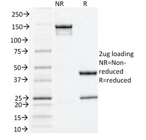 SDS-PAGE analysis of purified, BSA-free Estrogen Receptor alpha antibody (clone ESR1/1935) as confirmation of integrity and purity.