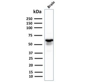 GAD67 Antibody Brain WB. Western blot analysis of human brain lysate using GAD67 Antibody detects a strong band at approximately 67 kDa, consistent with the expected molecular weight of Glutamate decarboxylase 67 / GAD1. This GABA synthesis enzyme antibody highlights abundant expression of inhibitory neurotransmitter-associated signaling machinery within neural tissue and supports characterization of GABAergic neuronal differentiation pathways.