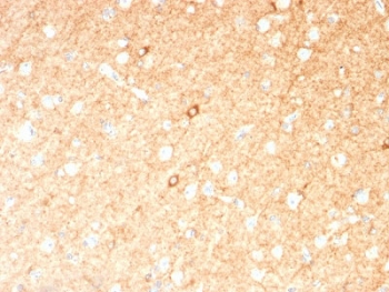 GAD67 Antibody Brain IHC. Immunohistochemistry analysis of FFPE human brain tissue stained with GAD67 Antibody demonstrates diffuse cytoplasmic HRP-DAB brown staining throughout neural parenchyma with enhanced labeling of scattered neuronal cell bodies, consistent with Glutamate decarboxylase 67 / GAD1 expression in GABAergic neuronal populations. This GABA synthesis enzyme antibody highlights inhibitory neurotransmitter-associated signaling pathways and neuronal differentiation within central nervous system tissue. Required HIER: boil tissue sections in 10mM citrate buffer, pH 6, for 10-20 min.