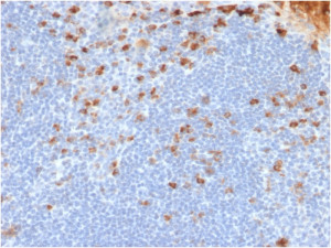 IHC testing of FFPE human tonsil tissue with recombinant Kappa Light Chain antibody (clone rL1C1). Required HIER: boil tissue sections in pH 9 10mM Tris with 1mM EDTA for 10-20 min followed by cooling at RT for 20 min.