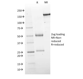 SDS-PAGE analysis of purified, BSA-free GAD67 antibody (clone GAD1/2563) as confirmation of integrity and purity.