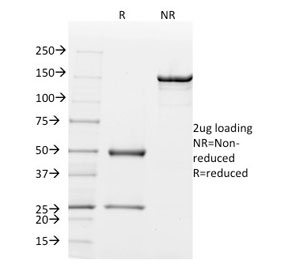 SDS-PAGE analysis of purified, BSA-free Mammaglobin antibody (clone MGB/2000) as confirmation of integrity and purity.