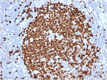 Ki-67 Antibody - Protein Microarray Validated / MKI67 Microarray Validated Antibody (clone MKI67/2465). Immunohistochemistry analysis of FFPE human tonsil tissue using protein microarray validated Ki-67 antibody (clone MKI67/2465). Strong nuclear brown staining is observed in numerous proliferating lymphoid cells within the tonsillar germinal center, consistent with the known expression pattern of Ki-67 / MKI67 in actively dividing cells. The microarray validated antibody highlights proliferating lymphocytes while surrounding non-proliferating stromal and background cells show minimal staining. Heat-induced epitope retrieval was performed by boiling tissue sections in 10mM citrate buffer (pH6) for 10-20 minutes followed by cooling at room temperature prior to staining.