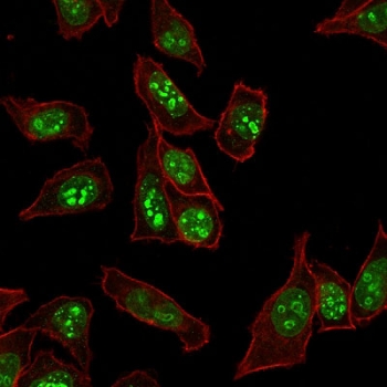 Immunofluorescent staining of human HeLa cells with microarray validated Ki-67 antibody (green, clone MKI67/2465) and Phalloidin (red, membrane stain).