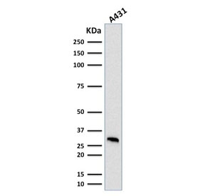 MTAP Antibody A431 WB. Western blot analysis of human A431 cell lysate using MTAP Antibody (clone MTAP/1813) detects a band at approximately 26-38 kDa, consistent with the predicted molecular weight of Methylthioadenosine phosphorylase (MTAP) and reflecting the presence of multiple isoforms of this metabolic enzyme.