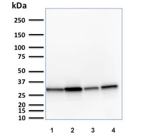 MTAP Antibody Multi-Cell Line WB. Western blot analysis of human HeLa, A431, HepG2, and HAP-1 cell lysates using MTAP Antibody (clone MTAP/1813) detects a band at approximately 26-38 kDa, consistent with the predicted molecular weight of Methylthioadenosine phosphorylase (MTAP) and reflecting the presence of multiple isoforms of this metabolic enzyme across diverse human cell lines.