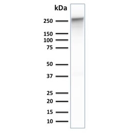 Western blot testing of human PANC-1 cell lysate with Spectrin beta III antibody. Predicted molecular weight ~246 kDa.
