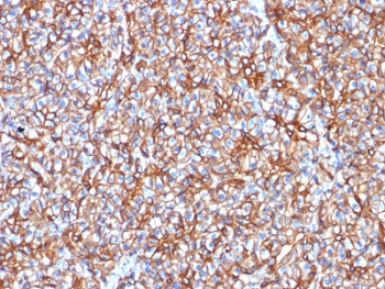 IHC testing of FFPE human pancreas with Spectrin beta III antibody (clone SPTBN2/1778). Required HIER: boil tissue sections in 10mM citrate buffer, pH 6, for 10-20 min followed by cooling at RT for 20 min.