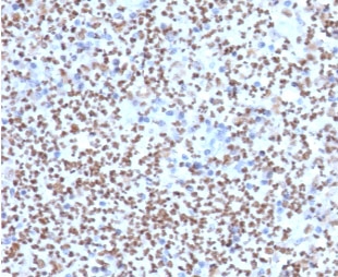 IHC staining of FFPE human lymph node with PU.1 antibody (clone TFPU1-1). HIER: boil tissue sections in pH 9 10mM Tris with 1mM EDTA for 10-20 min followed by cooling at RT for 20 min.
