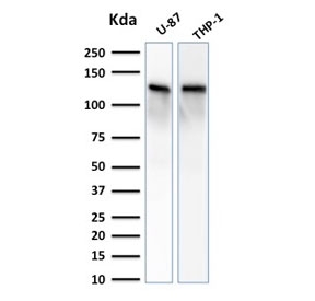 Western blot testing of 1) human U-87 MG and 2) human ThP-1 cell lysate with Vinculin antibody. Predicted molecular weight ~124 kDa.