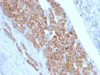 StAR Antibody Protein Microarray Validated Clone STAR/2140. Immunohistochemistry analysis of Steroidogenic Acute Regulatory Protein (StAR / STARD1) in FFPE human adrenal gland tissue using a mouse monoclonal antibody validated by large-scale protein microarray specificity screening. HRP-DAB brown cytoplasmic staining highlights steroidogenic cells of the adrenal cortex, consistent with the mitochondrial localization of StAR in steroid hormone-producing endocrine cells, while surrounding stromal and non-steroidogenic tissues show minimal staining. Heat-induced epitope retrieval was performed by boiling tissue sections in 10 mM citrate buffer, pH 6, for 10-20 minutes followed by cooling at room temperature for 20 minutes prior to staining.