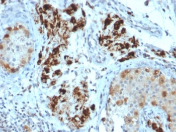 StAR Antibody Microarray Specificity Validated Clone STAR/2154. Immunohistochemistry analysis of Steroidogenic Acute Regulatory Protein (StAR / STARD1) in FFPE human adrenal gland tissue using a mouse monoclonal antibody validated by large-scale protein microarray specificity screening. HRP-DAB brown cytoplasmic staining highlights steroidogenic cells of the adrenal cortex, consistent with the mitochondrial localization of StAR in steroid hormone-producing endocrine cells, while surrounding non-steroidogenic tissues show minimal staining. Heat-induced epitope retrieval was performed by boiling tissue sections in pH 9 Tris-EDTA buffer (10 mM Tris with 1 mM EDTA) for 10-20 minutes followed by cooling at room temperature for 20 minutes prior to antibody staining.