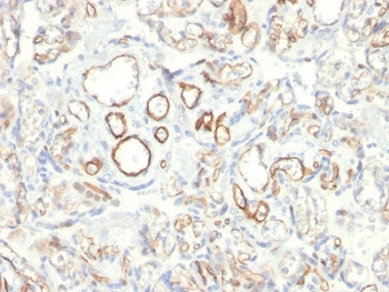 IHC testing of FFPE human placenta with Podocalyxin antibody (clone PODXL/2185). HIER: boil tissue sections in pH6, 10mM citrate buffer, for 10-20 min followed by cooling at RT for 20 min.