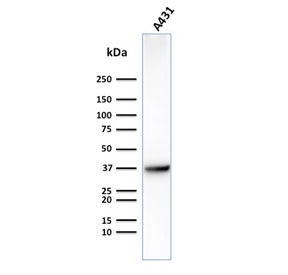 Western blot testing of human A431 cells with GLUT1 antibody (clone GLUT1/2475). Expected molecular weight: 45-55 kDa.