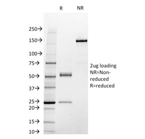 SDS-PAGE analysis of purified, BSA-free STAT3 antibody (clone STAT3/2409) as confirmation of integrity and purity.