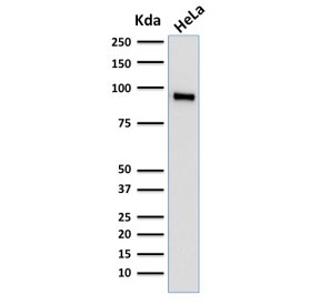 TLE1 Antibody Protein Microarray Validated Clone TLE1/2062 western blot analysis of Transducin-Like Enhancer Protein 1 / TLE1. Lane 1: human HeLa cell lysate. A band is detected at approximately 83 kDa, consistent with the predicted molecular weight of Transducin-Like Enhancer Protein 1 / TLE1. Clone TLE1/2062 is a Protein Microarray Validated antibody, indicating specificity was evaluated using large-scale protein microarray screening across extensive protein panels to assess selective recognition of the intended target protein. The detected band corresponds to endogenous TLE1 protein expressed in human HeLa cells, consistent with the nuclear transcriptional corepressor role of TLE1 within Groucho family transcriptional repression complexes.