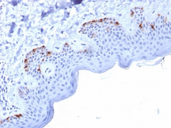 PMEL17 Antibody Glycosylated Protein. Immunohistochemistry analysis of human skin tissue stained with PMEL17 Antibody Glycosylated Protein clone PMEL/2037. Brown HRP-DAB chromogenic staining is observed in melanocytic cells located along the basal layer of the epidermis, consistent with expression of Premelanosome protein PMEL, also known as gp100, a melanosome-associated glycoprotein characteristic of melanocytic lineage. The staining highlights scattered melanocytes within the epidermal basal layer while surrounding keratinocytes and dermal cells remain largely negative. Heat-induced epitope retrieval was performed by boiling sections in 10mM citrate buffer pH 6 for 10-20 minutes followed by cooling at room temperature prior to staining.