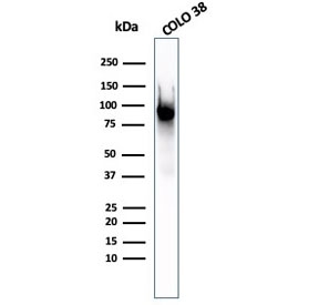 PMEL17 Antibody Glycosylated Protein. Western blot analysis of human COLO-38 melanoma cell lysate using PMEL17 Antibody Glycosylated Protein clone PMEL/2037. Lane 1: human COLO-38 cell lysate. A band is detected at approximately 100 kDa, consistent with the glycosylated precursor form of Premelanosome protein PMEL, also known as gp100. PMEL is synthesized as a glycosylated precursor that migrates near approximately 100 kDa before undergoing proteolytic cleavage into an approximately 60-64 kDa M-alpha fragment and an approximately 26 kDa M-beta fragment. The M-alpha fragment is further processed into approximately 34-38 kDa and approximately 26 kDa fragments that assemble into the fibrillar matrix of developing melanosomes in melanocytic cells.