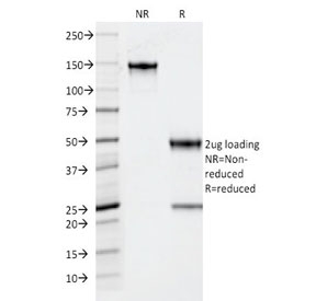 SDS-PAGE analysis of purified, BSA-free Thyroid Peroxidase antibody (clone TPO/1922) as confirmation of integrity and purity.