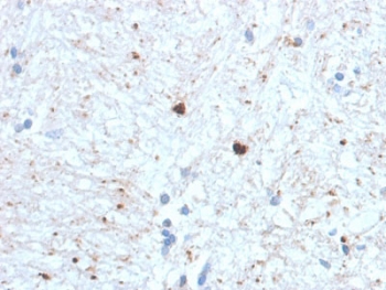 IHC staining of FFPE human brain with Ubiquitin/UBB antibody (clone UBB/1748). Required HIER: boil tissue sections in 10mM citrate buffer, pH 6, for 10-20 min followed by cooling at RT for 20 min.
