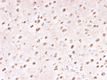 IHC staining of FFPE human brain with Ubiquitin/UBB antibody (clone UBB/1748). Required HIER: boil tissue sections in 10mM citrate buffer, pH 6, for 10-20 min followed by cooling at RT for 20 min.