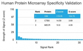 Vimentin Antibody Clone VM452 / VIM Mesenchymal Marker Antibody Protein Microarray Validation. Analysis of the HuProt(TM) human protein microarray containing more than 19,000 full-length human proteins using Vimentin Antibody Clone VM452 / VIM Mesenchymal Marker Antibody demonstrates exceptional target specificity. Clone VM452 produced a strong signal for VIM with a Z-score of 119.35 and an S-score of 104.76, supporting highly selective recognition of vimentin with minimal cross-reactivity. The Z-score reflects the strength of antibody binding relative to the array background, while the S-score represents the specificity of the antibody for its intended target compared with the next highest-ranking proteins.