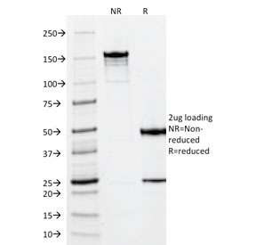 SDS-PAGE analysis of purified, BSA-free Vimentin antibody (clone VM452) as confirmation of integrity and purity.