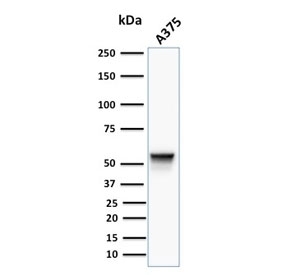 Vimentin Antibody Clone VM452 / VIM Mesenchymal Marker Antibody A375 Cell WB. Western blot analysis of A375 cell lysate using Vimentin Antibody Clone VM452 / VIM Mesenchymal Marker Antibody. A distinct immunoreactive band is detected at approximately 53-58 kDa, consistent with the expected molecular weight of vimentin, supporting specific detection of the endogenous type III intermediate filament protein in A375 melanoma cells.
