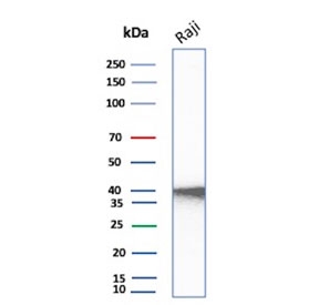 Western blot testing of human Raji cell lysate with CD40 antibody. Expected molecular weight is 30-45 kDa depending on glycosylation level.